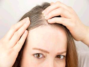 التوتر قد يسبب ظهور الشعر الأبيض قبل سن الثلاثين